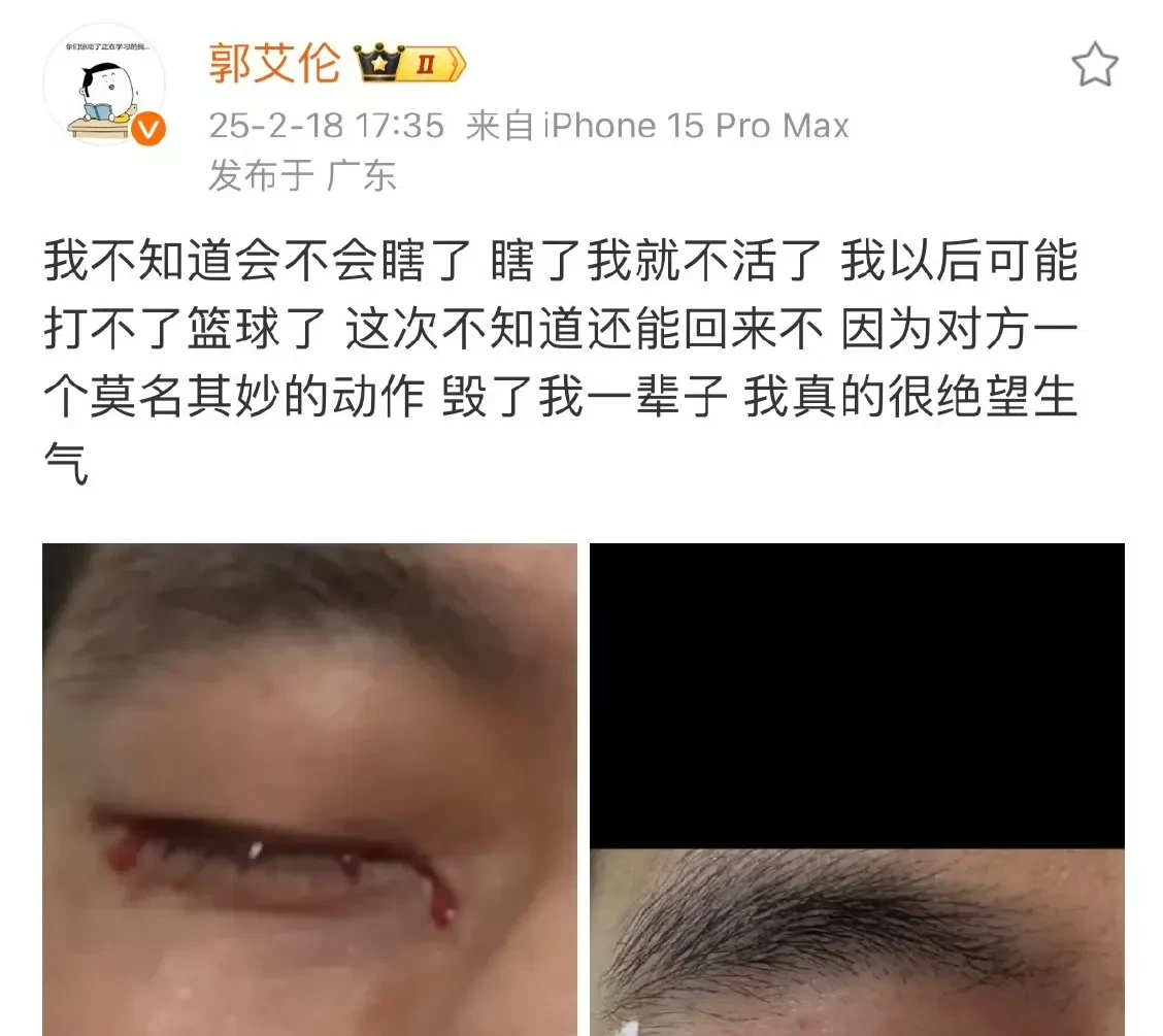 国际杯篮球赛出现名将受伤情况 国际杯篮球赛出现名将受伤情况